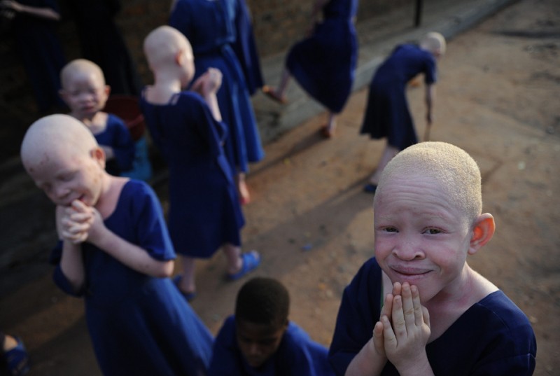  Альбиносы в Танзании 