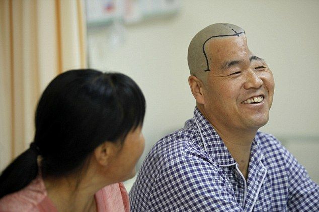 Врачи распечатали китайскому фермеру новый череп 