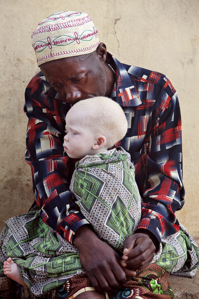 Страшная доля альбиносов Танзании 
